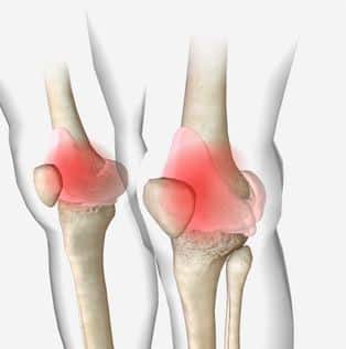 Why can Vitamin D deficiency cause joint pain and swelling?