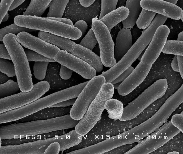 5 Benefits of Bifidobacterium Bifidum (Where is it Found?)